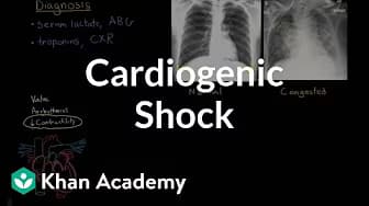 Circulatory system diseases | NCLEX-RN | Khan Academy